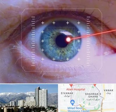 فمتولیزیک در شهرک غرب 