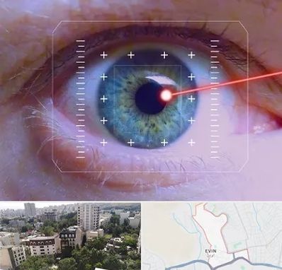 فمتولیزیک در اوین