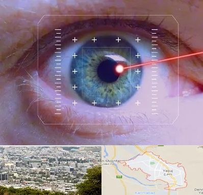 فمتولیزیک در یاسوج