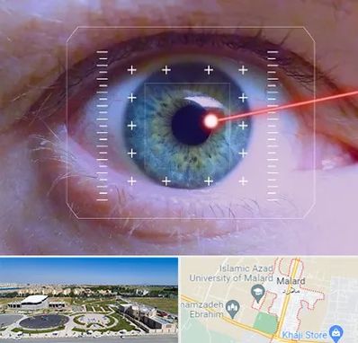 فمتولیزیک در ملارد