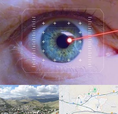 فمتولیزیک در رودهن