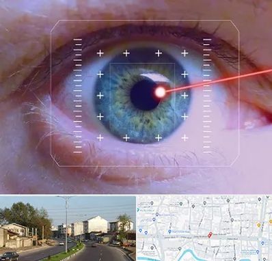 فمتولیزیک در ضیابری رشت