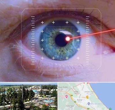 فمتولیزیک در رودسر