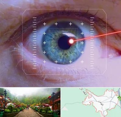 فمتولیزیک در فومن