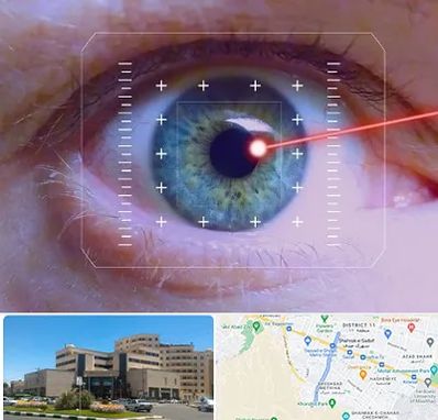 فمتولیزیک در صیاد شیرازی مشهد