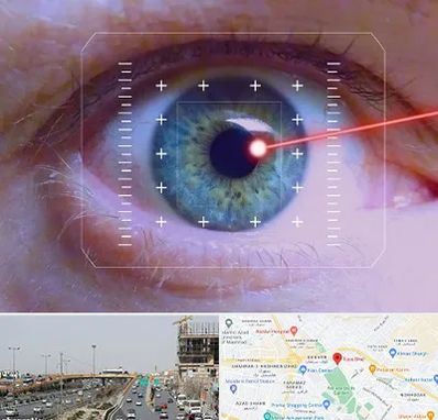 فمتولیزیک در بلوار توس مشهد 