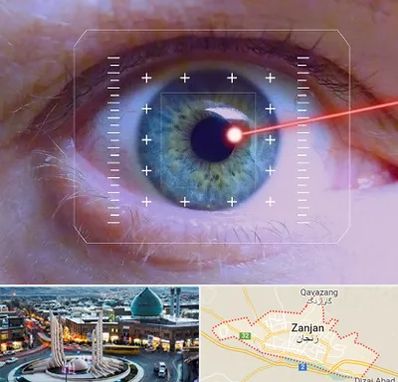 فمتولیزیک در زنجان