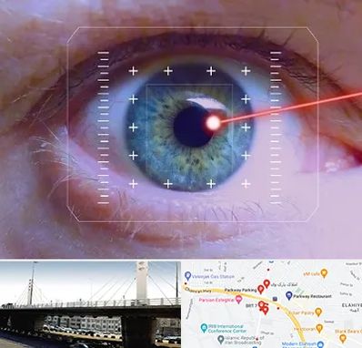 فمتولیزیک در پارک وی 