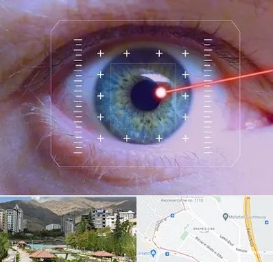 فمتولیزیک در شهر زیبا 