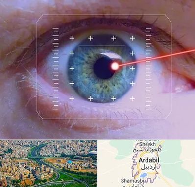 فمتولیزیک در اردبیل