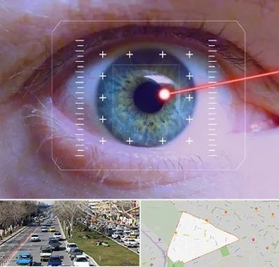 فمتولیزیک در احمدآباد مشهد 