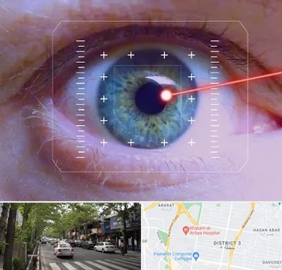 فمتولیزیک در ظفر 