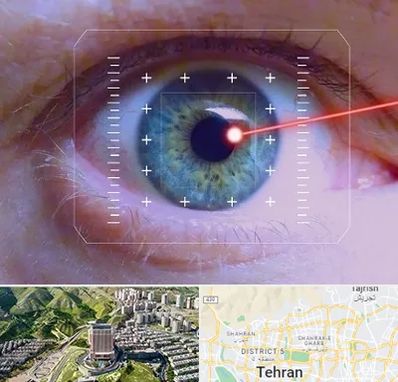 فمتولیزیک در شمال تهران 