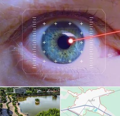 فمتولیزیک در لنگرود