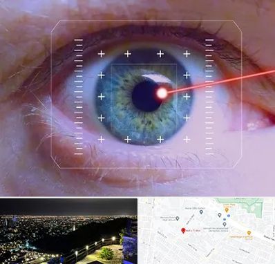 فمتولیزیک در هفت تیر مشهد 