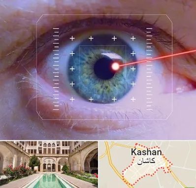 فمتولیزیک در کاشان