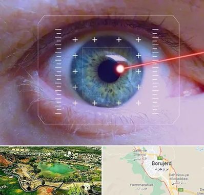 فمتولیزیک در بروجرد