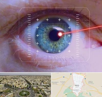 فمتولیزیک در قزوین