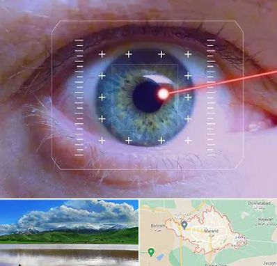 فمتولیزیک در مرند