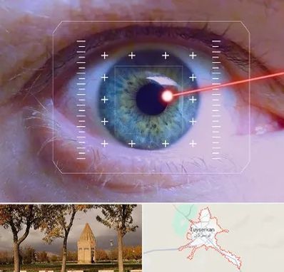 فمتولیزیک در تویسرکان