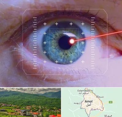 فمتولیزیک در آمل