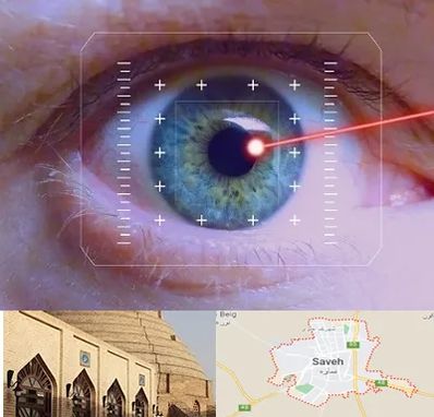 فمتولیزیک در ساوه