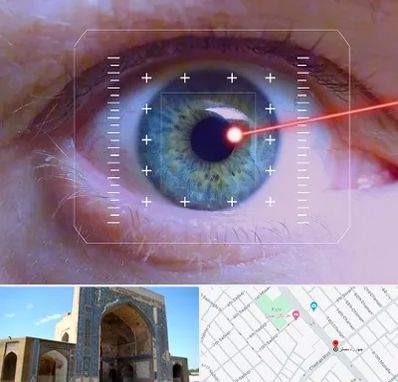 فمتولیزیک در مصلی مشهد