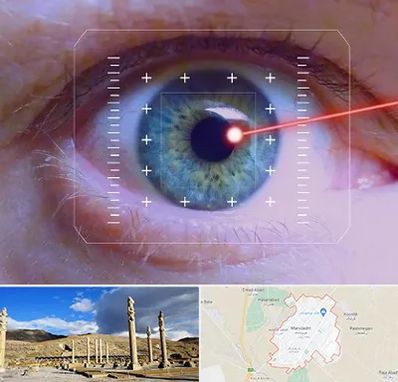 فمتولیزیک در مرودشت