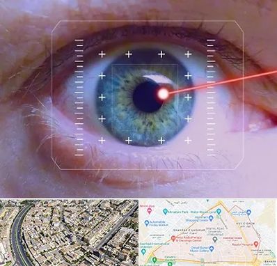 فمتولیزیک در شهرک غرب مشهد