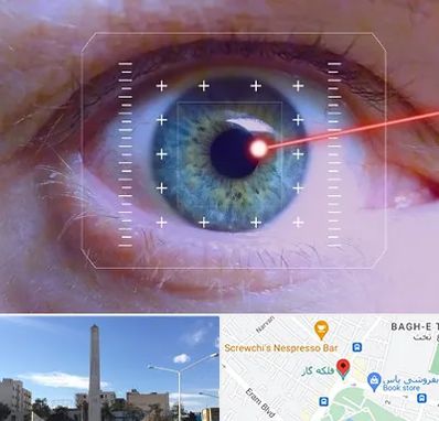 فمتولیزیک در فلکه گاز شیراز