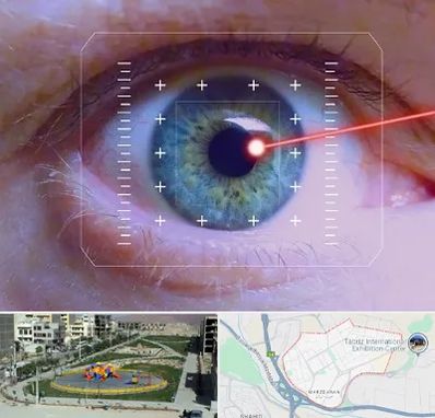 فمتولیزیک در مرزداران تبریز