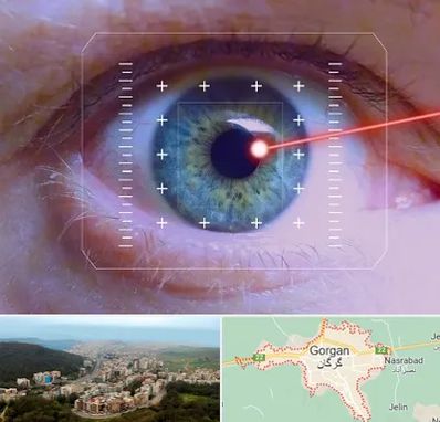 فمتولیزیک در گرگان