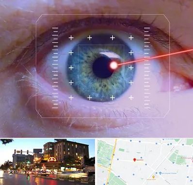 فمتولیزیک در بلوار سجاد مشهد 