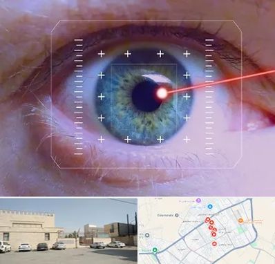 فمتولیزیک در نواب اسلامشهر