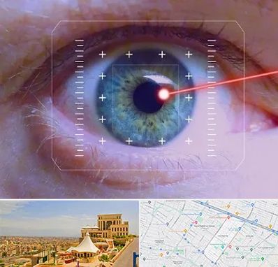 فمتولیزیک در هاشمیه مشهد