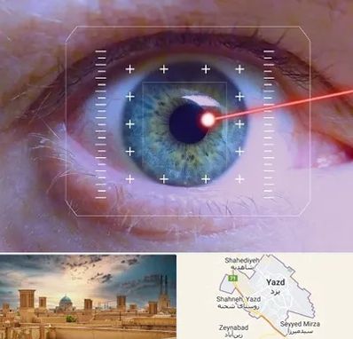 فمتولیزیک در یزد