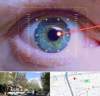 فمتولیزیک در کوی فیروز تبریز