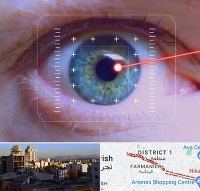 فمتولیزیک در فرمانیه 