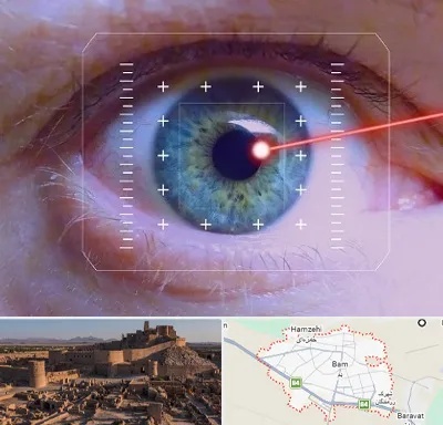 فمتولیزیک در بم