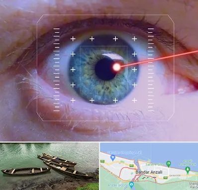 فمتولیزیک در بندر انزلی