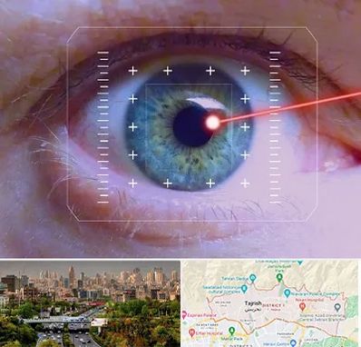 فمتولیزیک در منطقه 1 تهران 