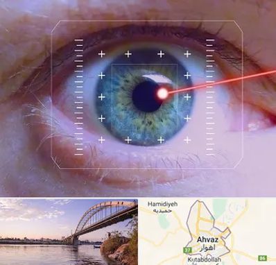 فمتولیزیک در اهواز