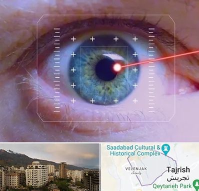 فمتولیزیک در زعفرانیه 