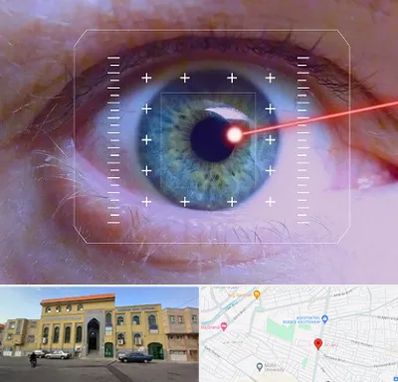 فمتولیزیک در زنبیل آباد قم