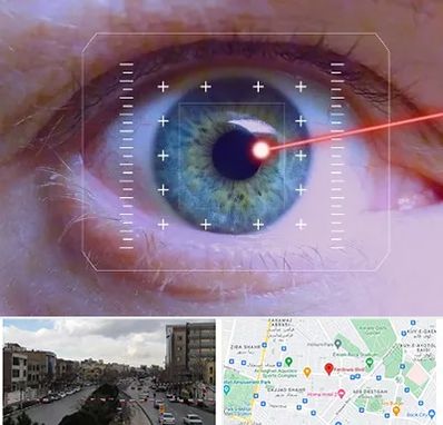 فمتولیزیک در بلوار فردوسی مشهد 