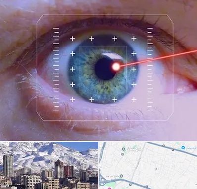 فمتولیزیک در ازگل