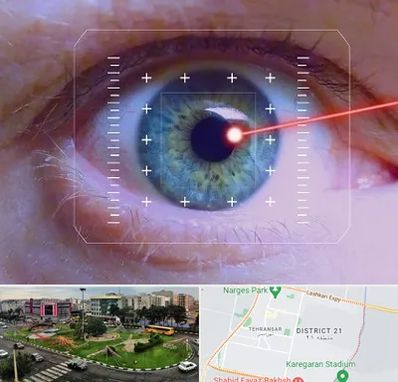 فمتولیزیک در تهرانسر 