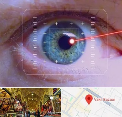 فمتولیزیک در بازار وکیل شیراز