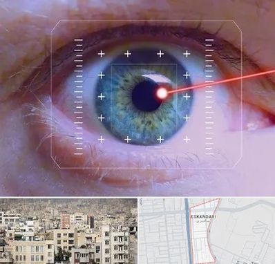 فمتولیزیک در اسکندری