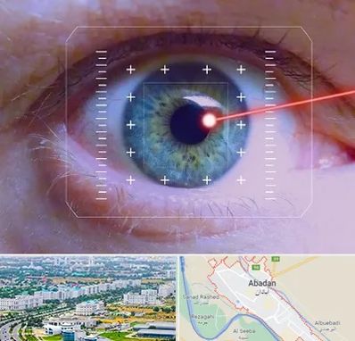 فمتولیزیک در آبادان